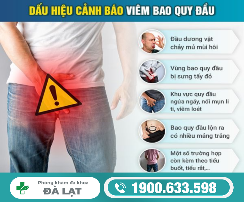 Hình ảnh minh họa